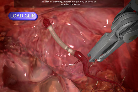 Vessel cauterization