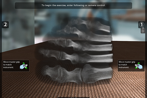 Volume rendering of foot